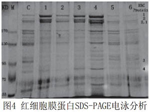 全血pH環(huán)境對(duì)紅細(xì)胞膜流動(dòng)性和膜蛋白的影